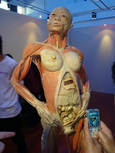 隋鸿锦的“母子同体”标本